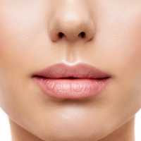 Dermal Fillers at CGT Aesthetics