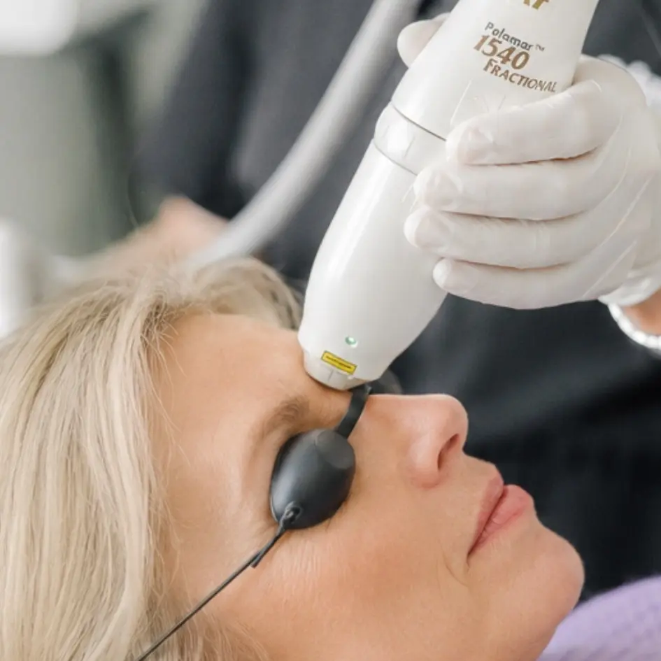 1540-scar-skin-resurfacing-laser-cgt-aesthetics-evergreen-park-westmont