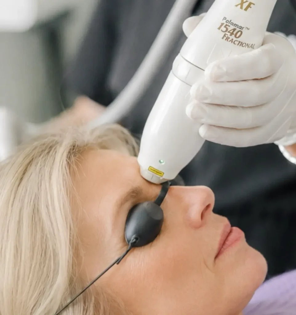 1540-scar-skin-resurfacing-laser-cgt-aesthetics-evergreen-park-westmont