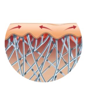 Illustration of radiofrequency energy delivered during Exilis Ultra 360 skin tightening treatments at CGT Aesthetics in Evergreen Park and Westmont, Illinois