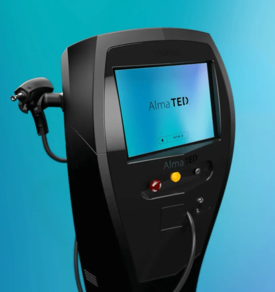 alma-ted-hair-restoration-device-evergreen-park-westmont Alma TED hair restoration device used for non-invasive hair restoration treatments in Evergreen Park and Westmont IL