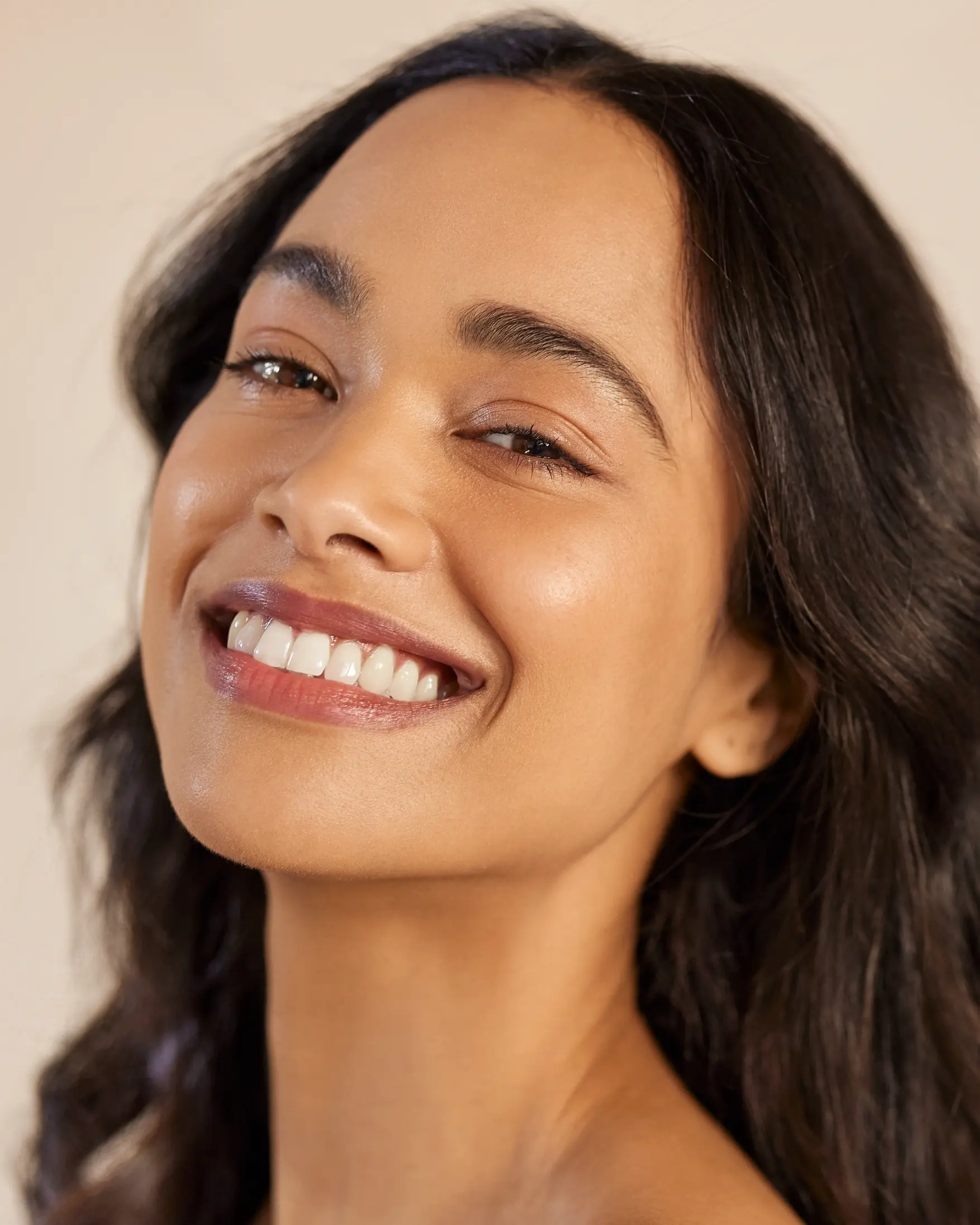 Photo of a smiling woman used as a guide to facial filler treatment areas including lips, cheeks, jawline, chin, under eyes, smile lines, marionette lines, and temples