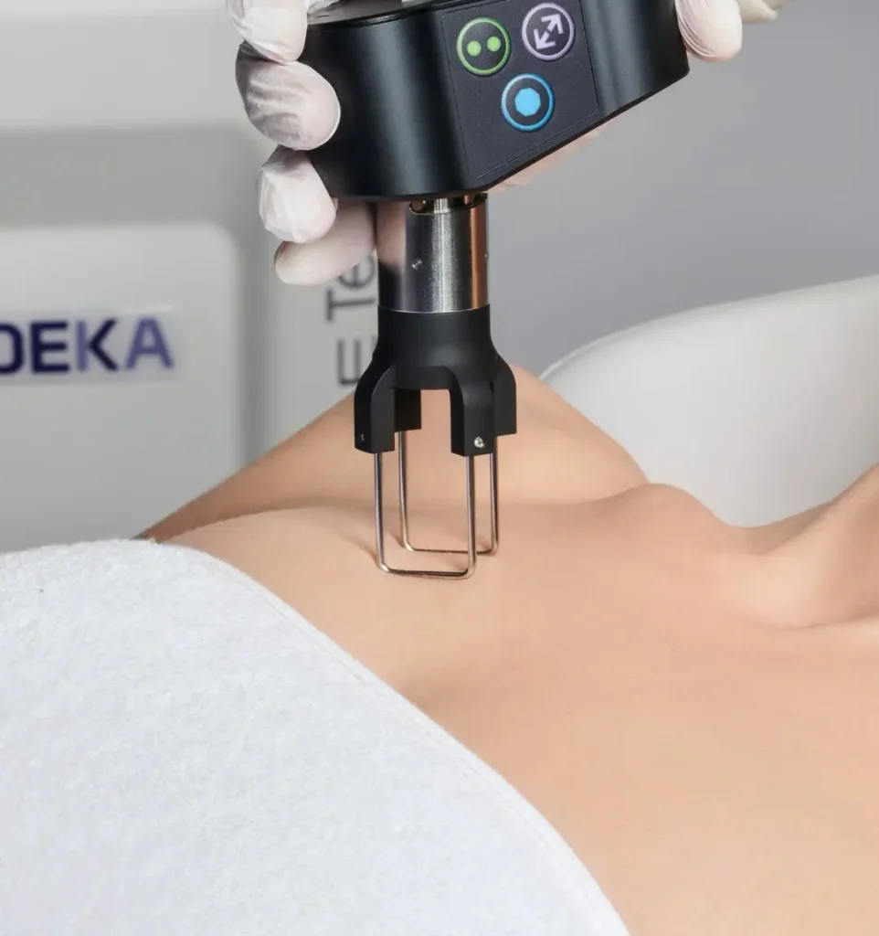 DEKA CO2 laser skin resurfacing treatment performed at CGT Aesthetics in Evergreen Park and Westmont, Illinois
