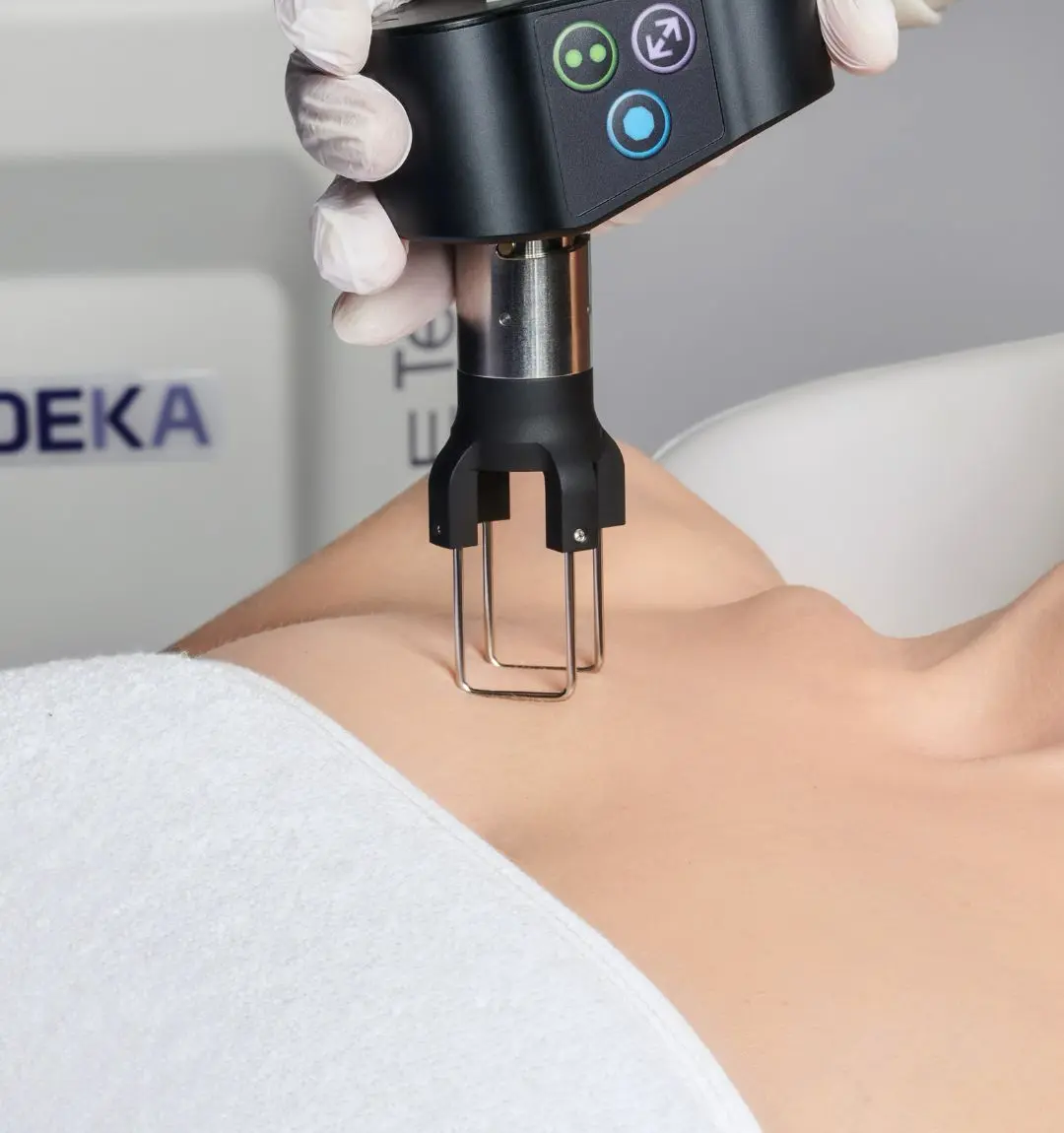 DEKA & Coolpeel CO₂ Lasers