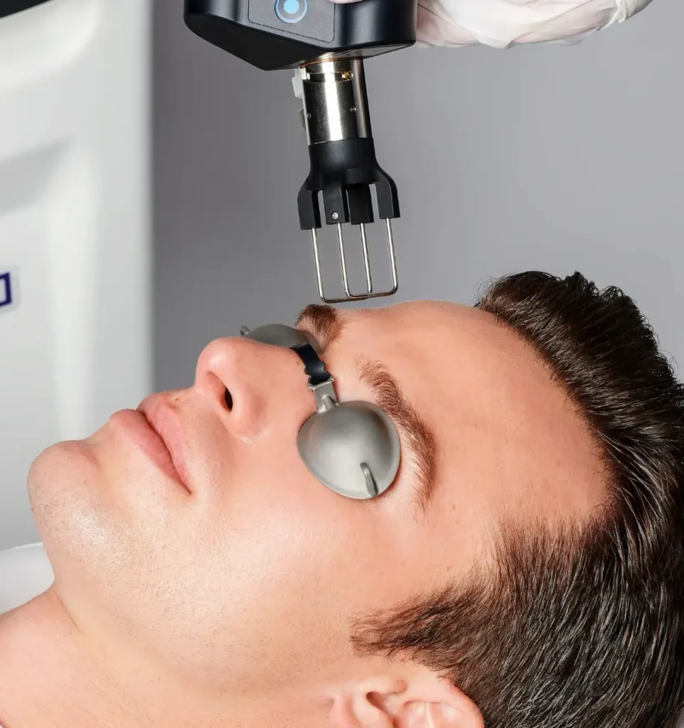 coolpeel-c02-laser-westmont-evergreen-park-il