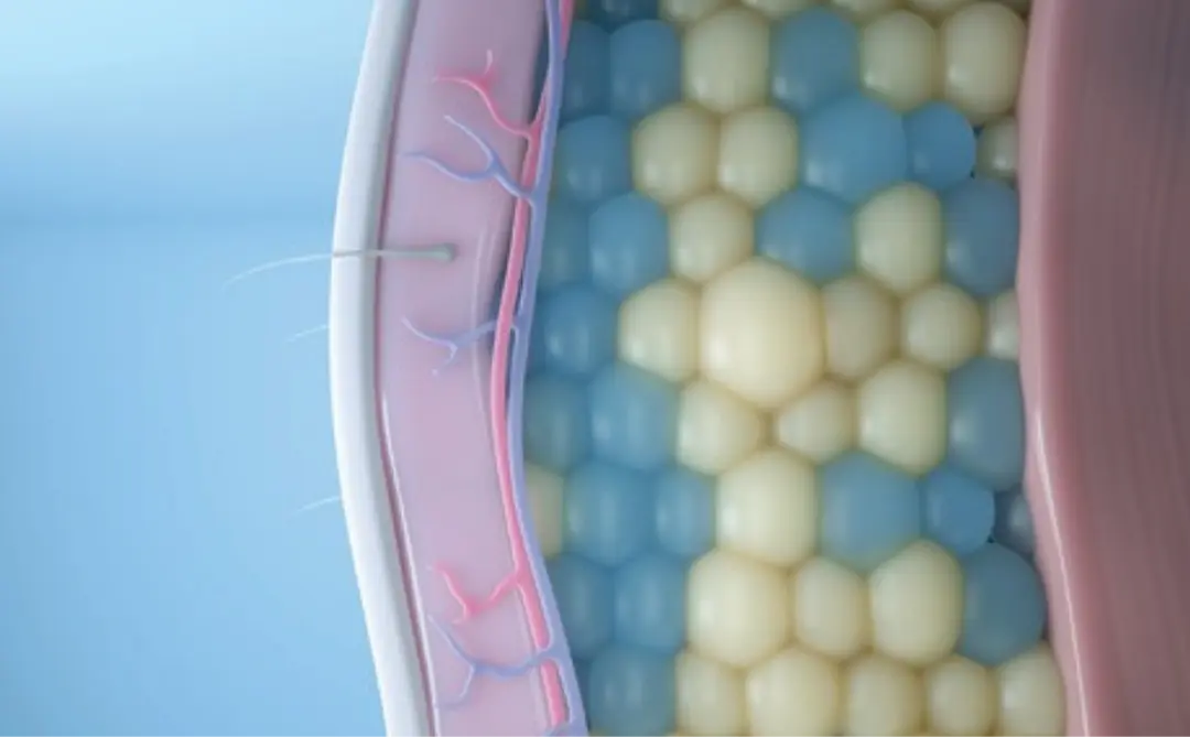 Illustration showing targeted fat reduction with CoolSculpting Elite at CGT Aesthetics in Evergreen Park and Westmont, Illinois