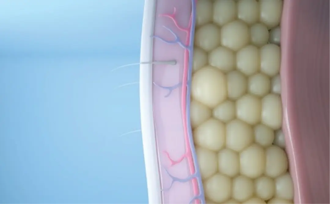 Illustration showing targeted fat reduction with CoolSculpting Elite at CGT Aesthetics in Evergreen Park and Westmont, Illinois