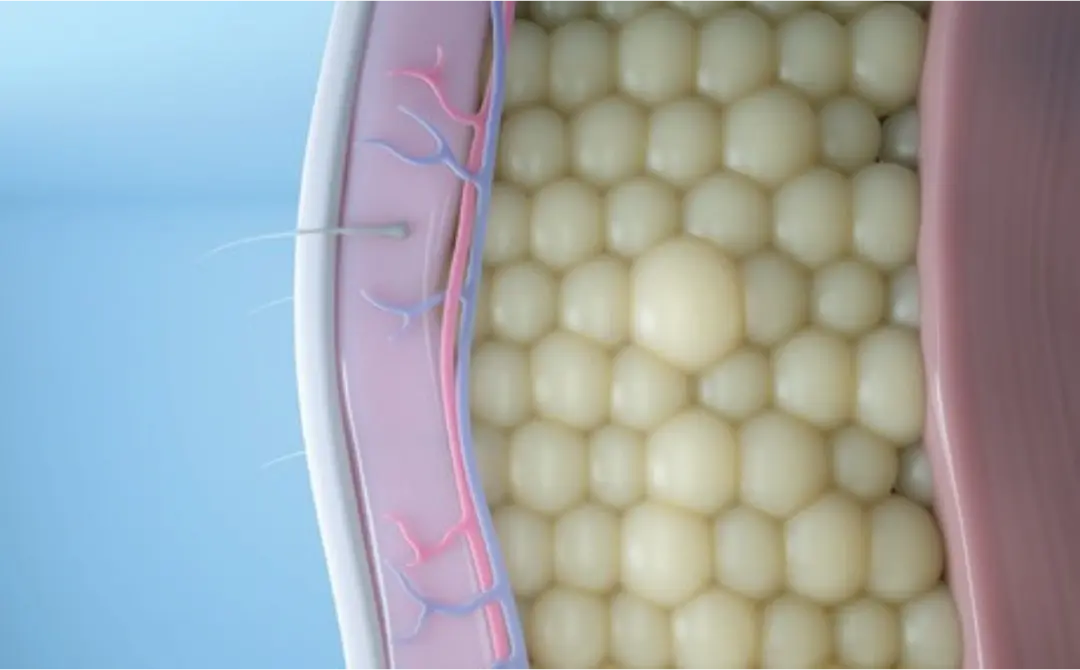 Illustration showing targeted fat reduction with CoolSculpting Elite at CGT Aesthetics in Evergreen Park and Westmont, Illinois