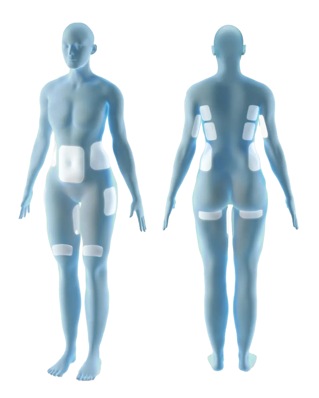 Dual body map — front and back views — showing CoolSculpting Elite treatment areas: submental/under the chin, flanks, abdomen, inner thighs, outer thighs, above the knees, upper arms, bra puff, back fat/bra fat, and banana roll
