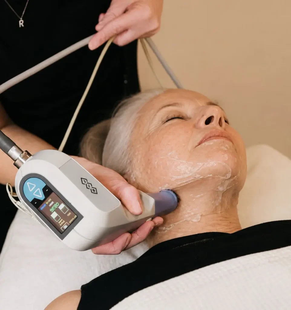 Exilis treatment for skin tightening and collagen support in Evergreen Park and Westmont IL