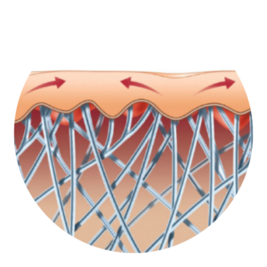 Illustration of tightened skin and remodeled collagen fibers after Exilis Ultra 360 treatment.