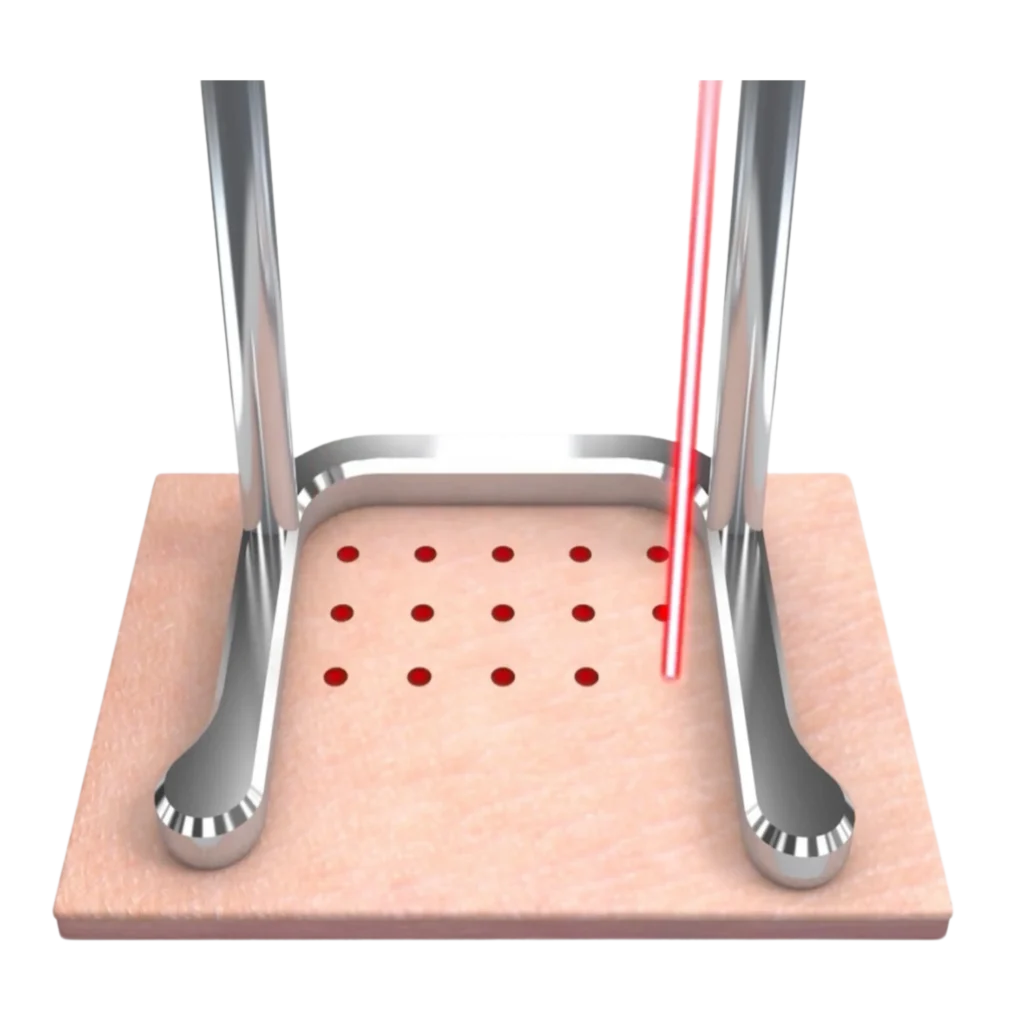 fractional-co2-laser-ablation-collagen-stimulation-diagram