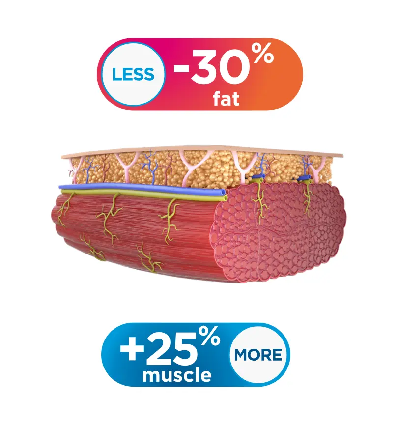 Emsculpt Neo body sculpting treatment designed to reduce fat and strengthen muscle at CGT Aesthetics in Evergreen Park and Westmont, Illinois