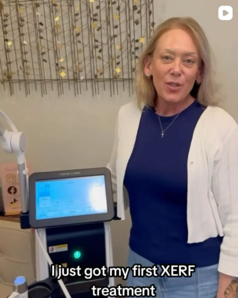 Patient sharing her first XERF skin tightening treatment experience at CGT Aesthetics in Evergreen Park and Westmont IL