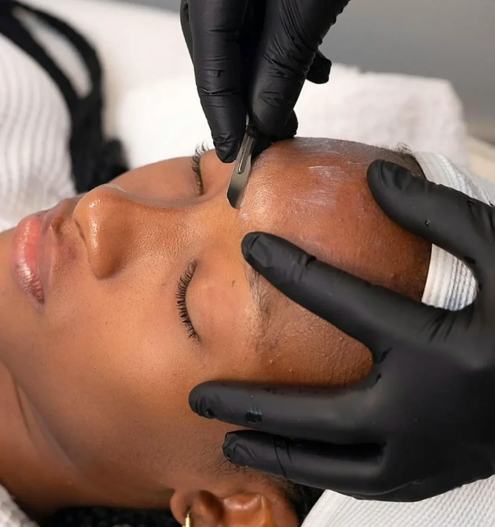 advanced-dermaplaning-westmont-il