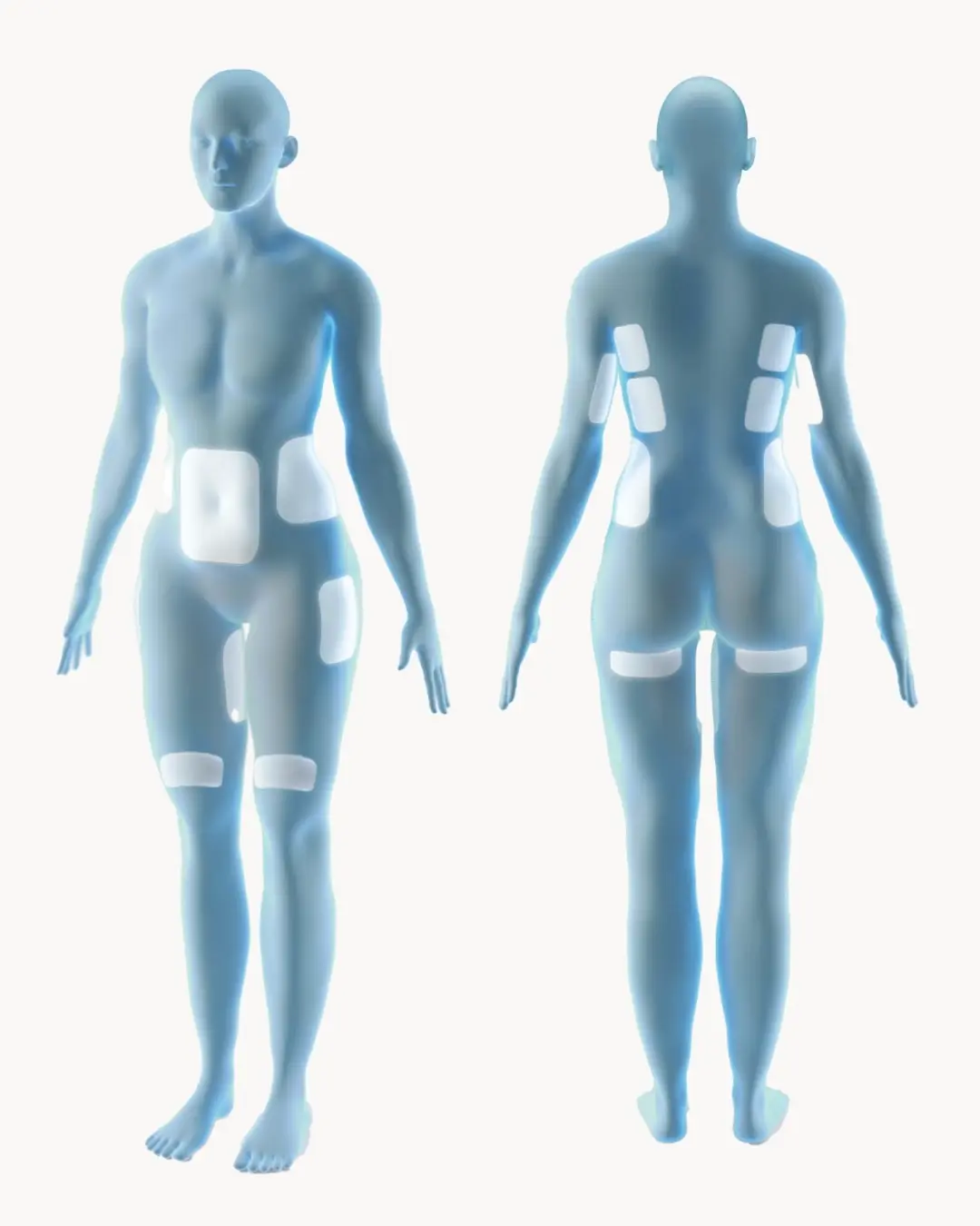 Dual body map — front and back views — showing CoolSculpting Elite treatment areas: double chin, jawline, flanks, abdomen, inner thighs, outer thighs, upper arms, bra fat, back fat, and banana roll