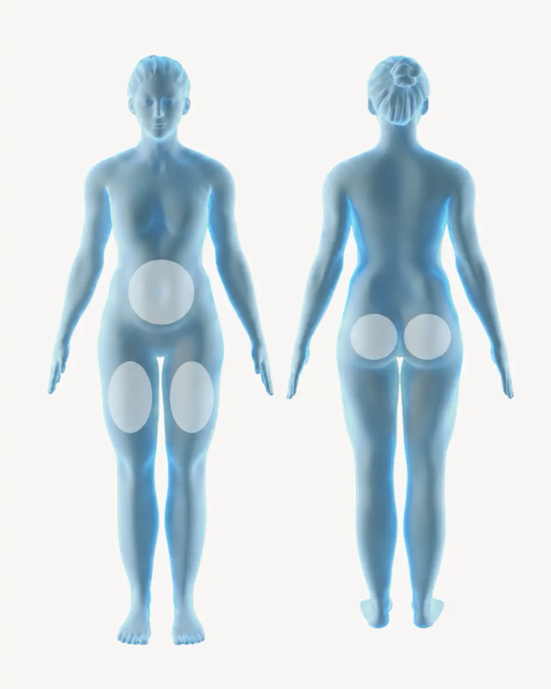 CoolTone treatment areas body map showing front and back views