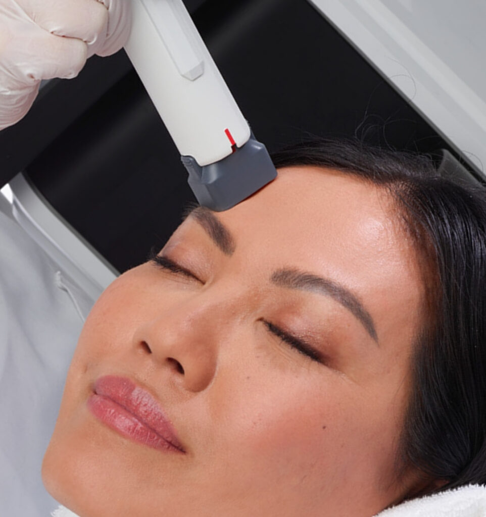 XERF skin tightening treatment at CGT Aesthetics in Evergreen Park and Westmont