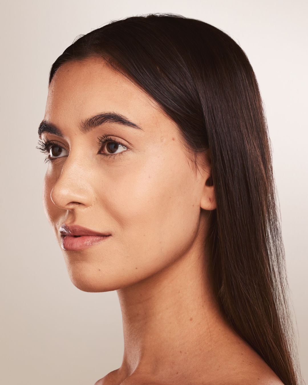 Woman's profile showing facial areas treated with Botox and Dysport — CGT Aesthetics